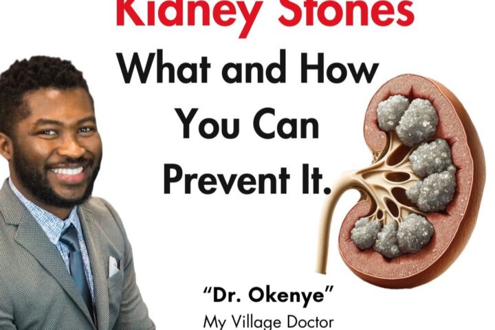 We delve into kidney stones, uncovering the common types; exploring their causes, and discussing how your diet impacts their formation.